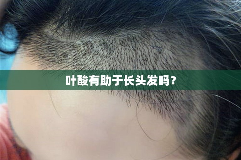 叶酸有助于长头发吗？