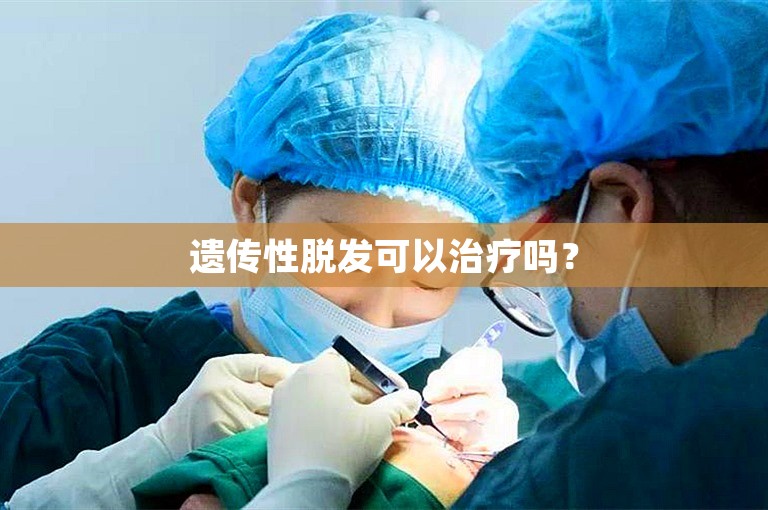 遗传性脱发可以治疗吗？