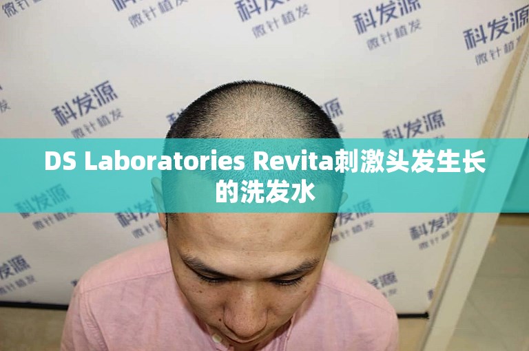 DS Laboratories Revita刺激头发生长的洗发水