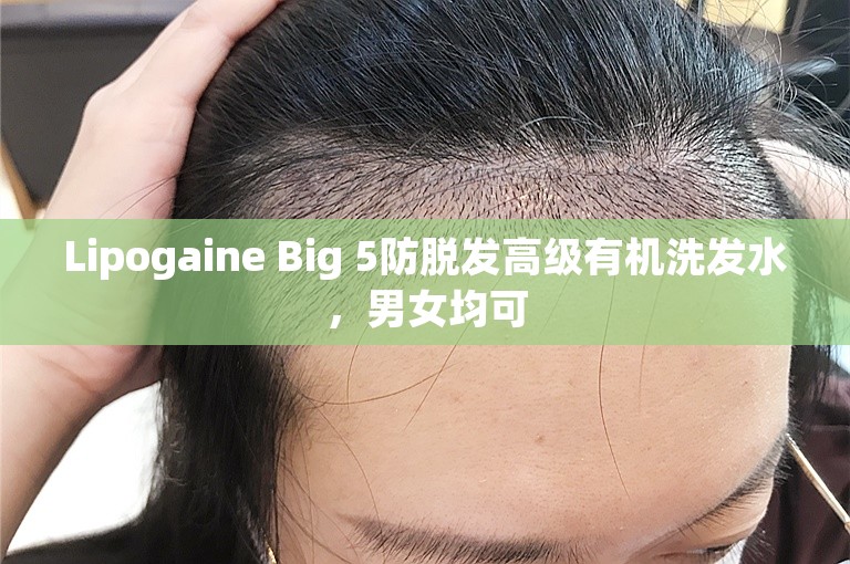 Lipogaine Big 5防脱发高级有机洗发水，男女均可