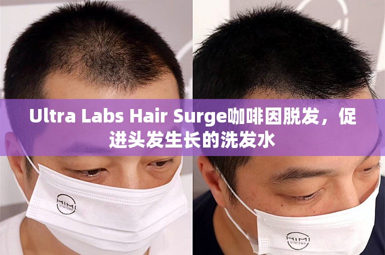 Ultra Labs Hair Surge咖啡因脱发，促进头发生长的洗发水