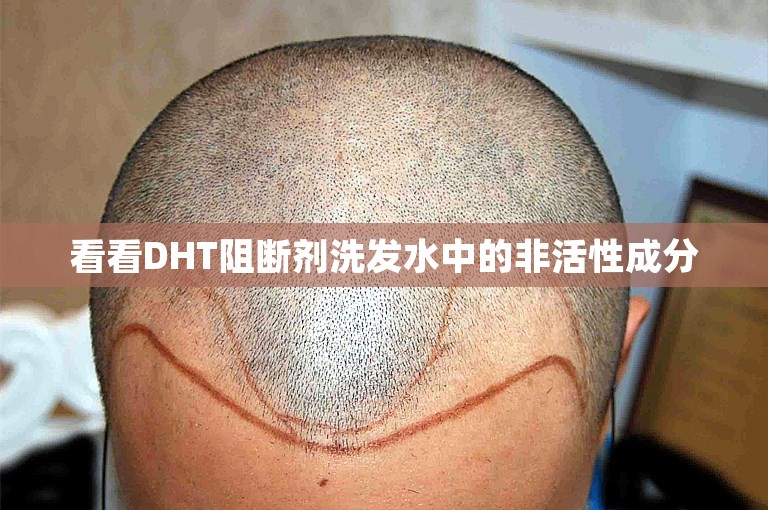 看看DHT阻断剂洗发水中的非活性成分
