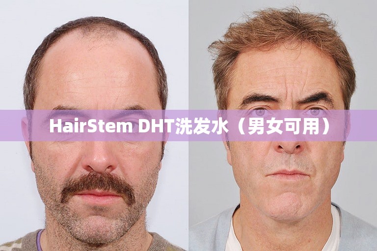 HairStem DHT洗发水（男女可用）