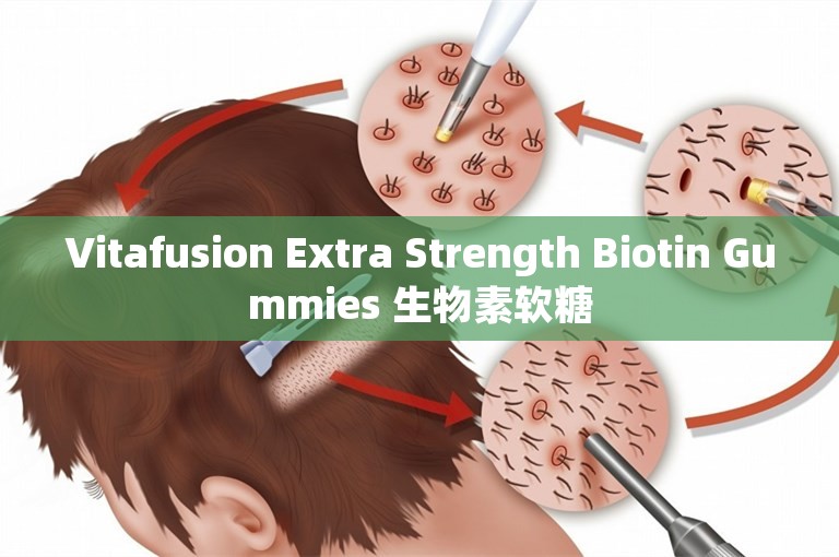 Vitafusion Extra Strength Biotin Gummies 生物素软糖