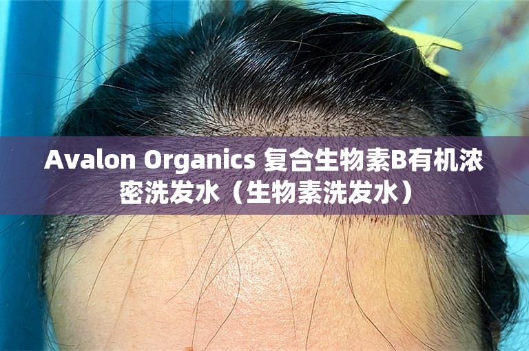 Avalon Organics 复合生物素B有机浓密洗发水（生物素洗发水）