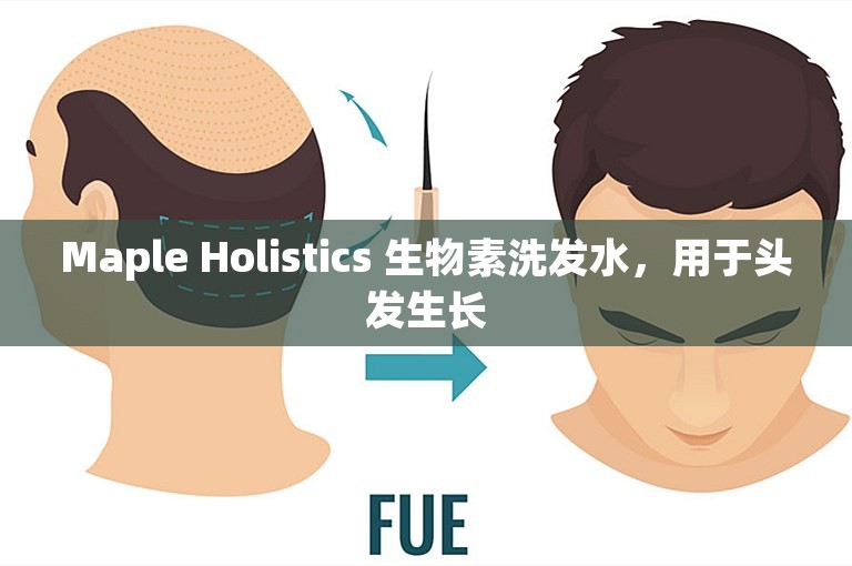 Maple Holistics 生物素洗发水，用于头发生长