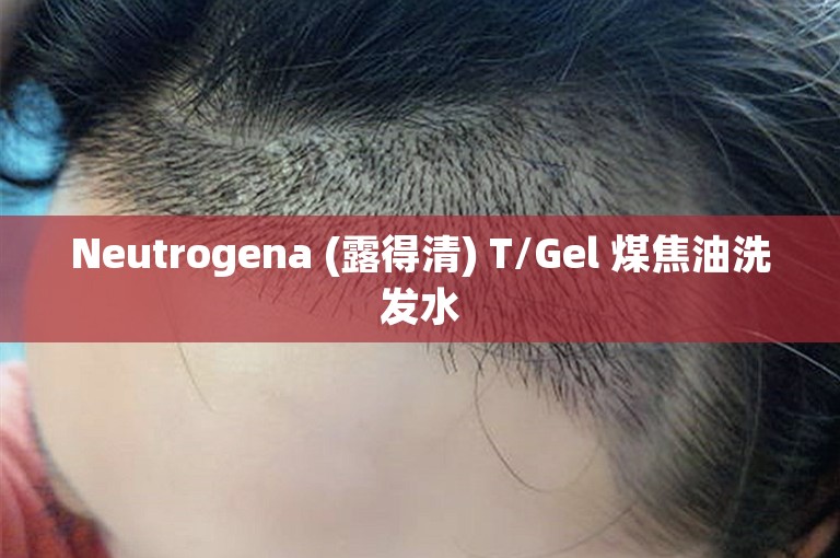 Neutrogena (露得清) T/Gel 煤焦油洗发水