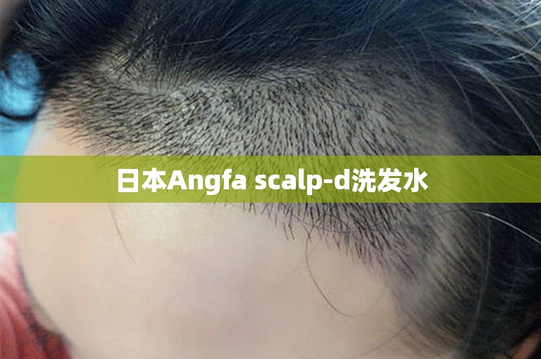 日本Angfa scalp-d洗发水
