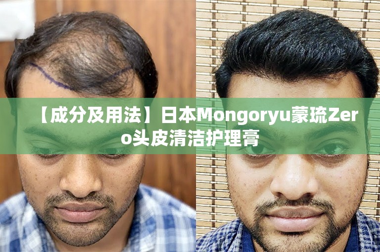 【成分及用法】日本Mongoryu蒙琉Zero头皮清洁护理膏