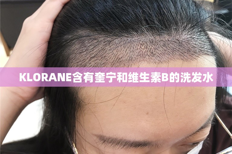 KLORANE含有奎宁和维生素B的洗发水
