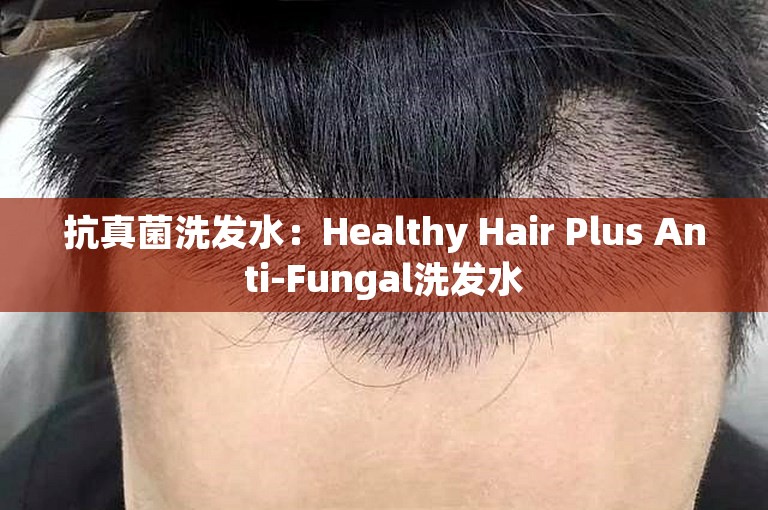 抗真菌洗发水：Healthy Hair Plus Anti-Fungal洗发水
