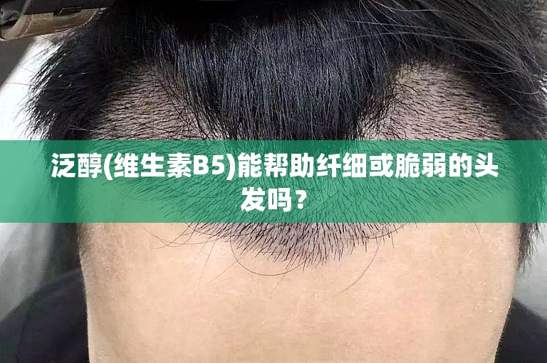泛醇(维生素B5)能帮助纤细或脆弱的头发吗？