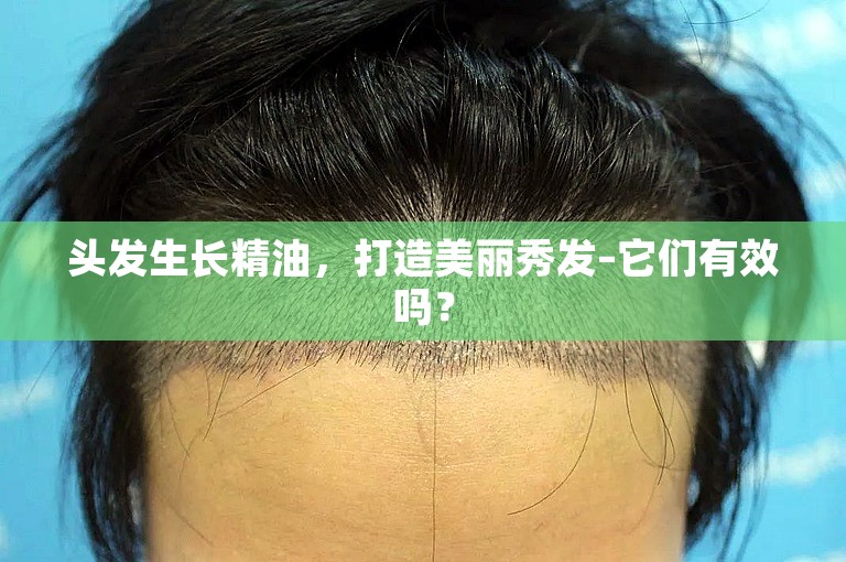 头发生长精油，打造美丽秀发–它们有效吗？