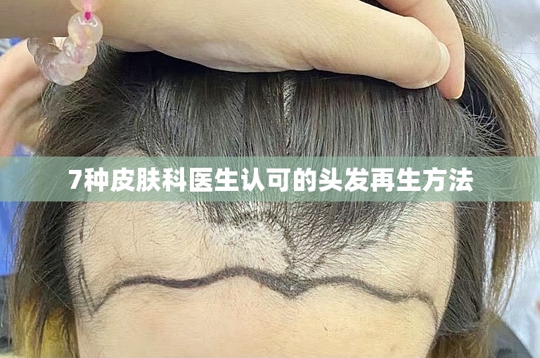 7种皮肤科医生认可的头发再生方法