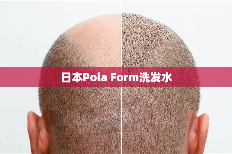 日本Pola Form洗发水