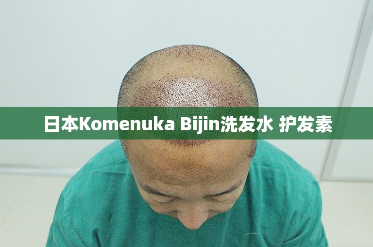 日本Komenuka Bijin洗发水 护发素