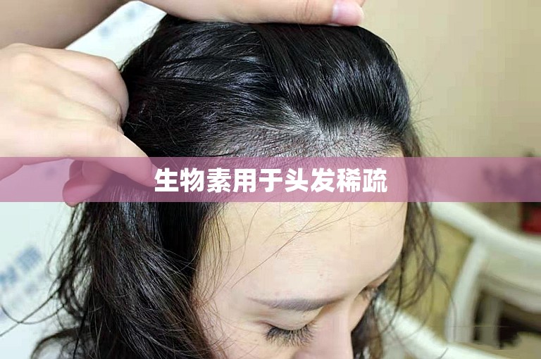 生物素用于头发稀疏