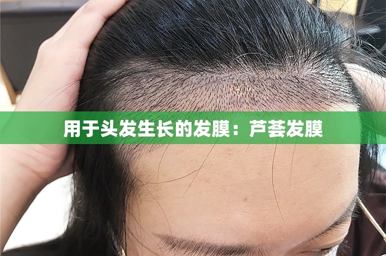 用于头发生长的发膜：芦荟发膜