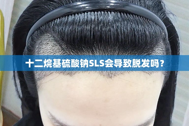 十二烷基硫酸钠SLS会导致脱发吗？