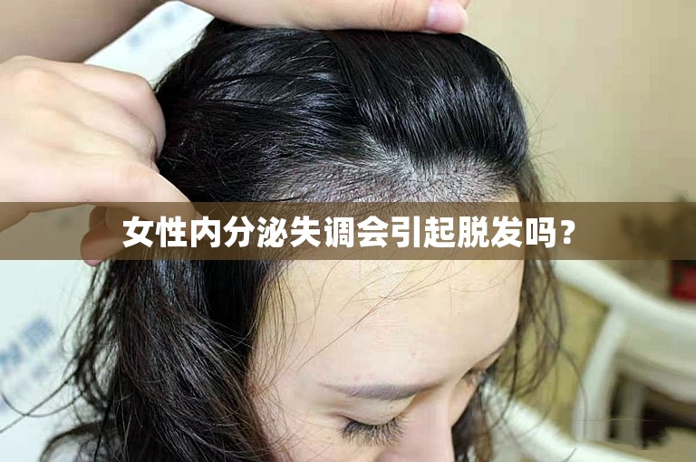 女性内分泌失调会引起脱发吗？