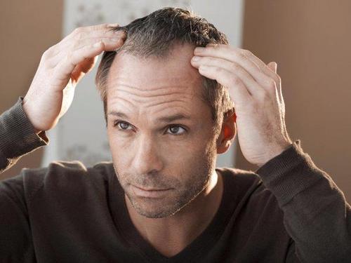男性怎么对自己的头发进行保养？