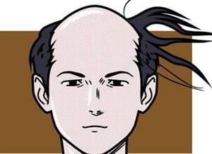 男性脱发都是什么原因引起的？男性脱发和肾虚有关吗？