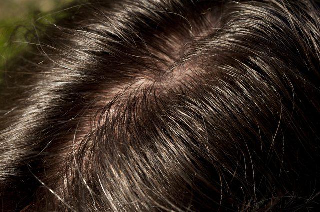 椰子油和橄榄油对头发的作用