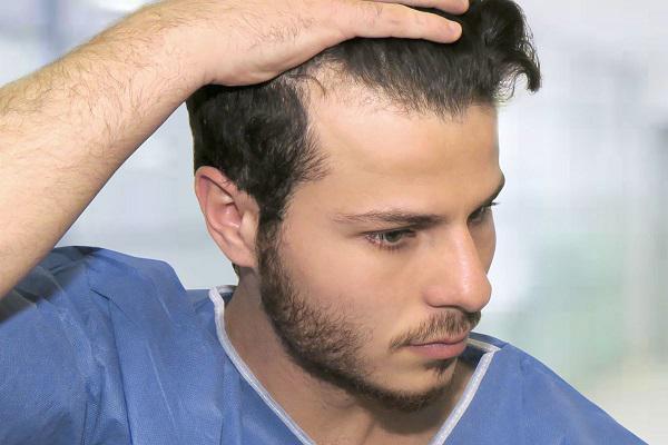 头发种植会产生后遗症吗？