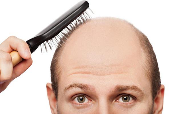 毛发种植手术过程是什么样