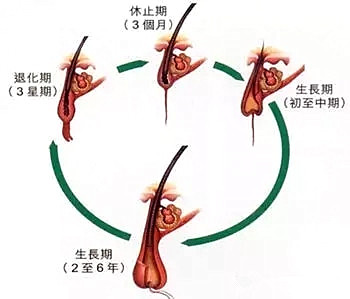 植发后头发必须要经历的四个阶段