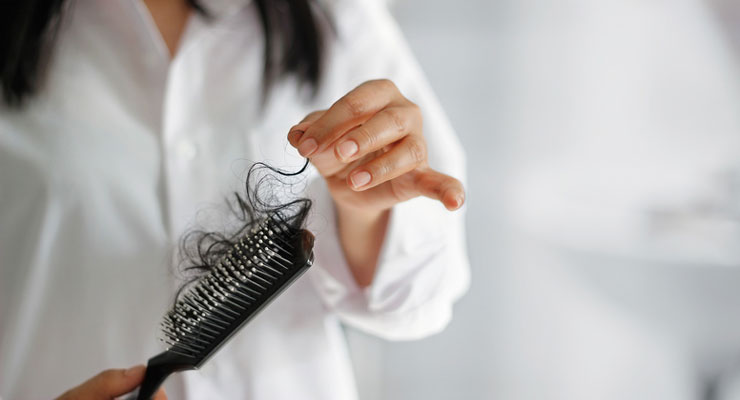 女人中年脱发可以种植吗？