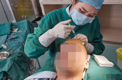 广州植发打麻醉会不会对大脑有影响？