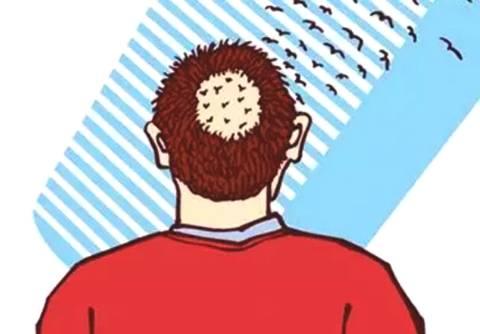脱发小知识：男性脱发的3种常见因素！