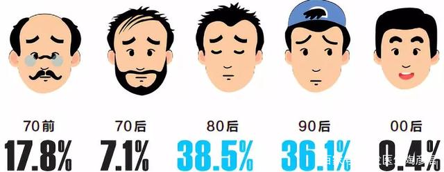 男性脱发比女性多？每天掉多少头发算脱发？