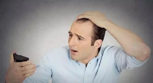治疗脱发最有效的3个方法