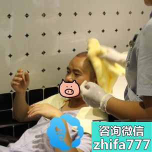 北京博士园植发案例：mut植发技术3200毛囊单位六个月恢复效果