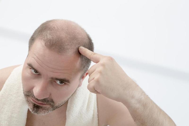 关于脱发你是真的了解吗？6个脱发原因，从根本上解决脱发问题！