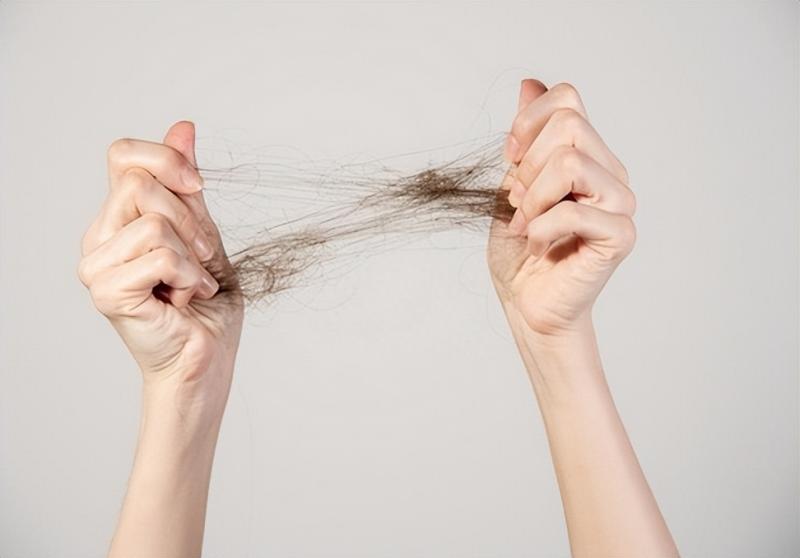 别轻易焦虑，掉头发很费钱：植发900元/平方厘米，头皮比地皮贵