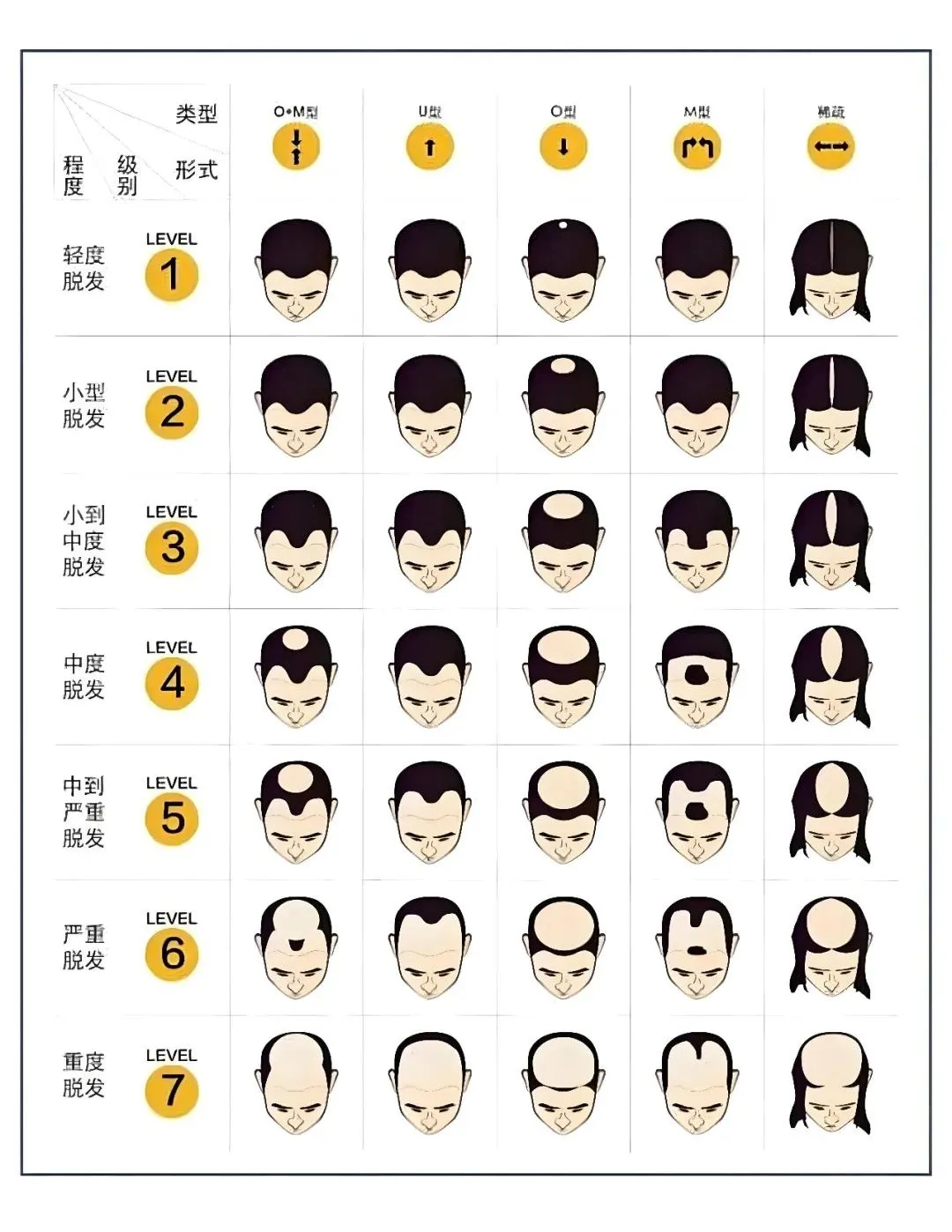 注意！这些植发价格套路不得不防！