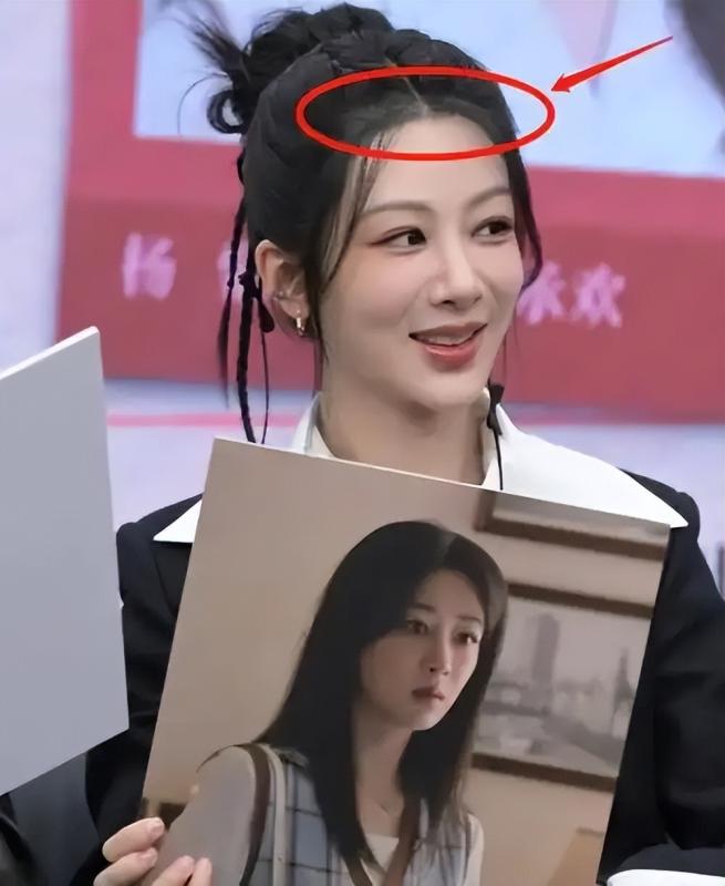 为什么明星植发都选高端植发技术