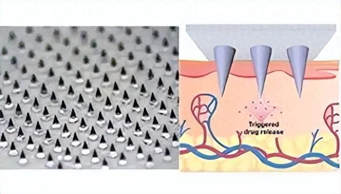 植发医生从不对外说的技术内幕,今天一次性讲清楚