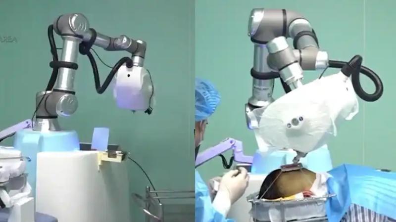 2025最新植发技术排名：FUE已不是最佳选择？