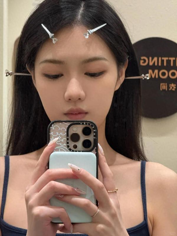 扎马尾星人有救了！植发2700单位满月日记