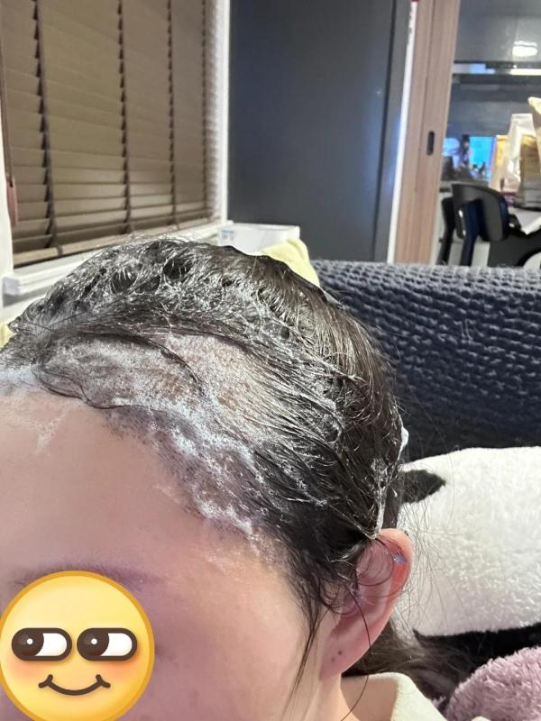 一位来云南的小姐姐分享她的植发后的记录，小姐姐真棒！