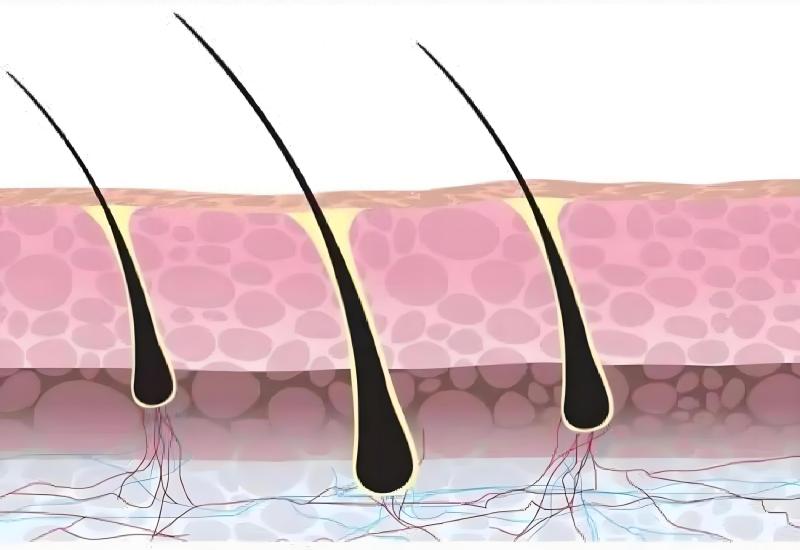 植发前必看的真相：6大危害与后遗症