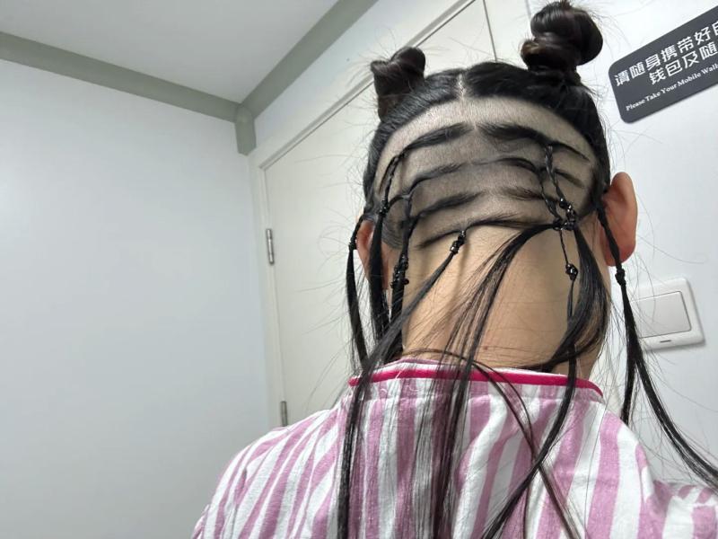 上海的小姐姐分享自己植发的亲身经历，真是太可爱了