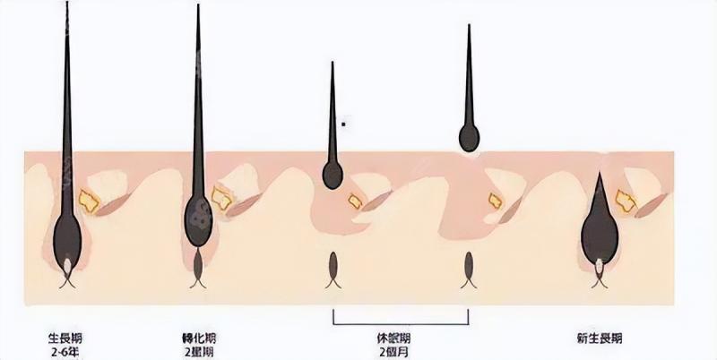发缝稀疏自救指南：如何让种植头发和原生发无缝衔接！