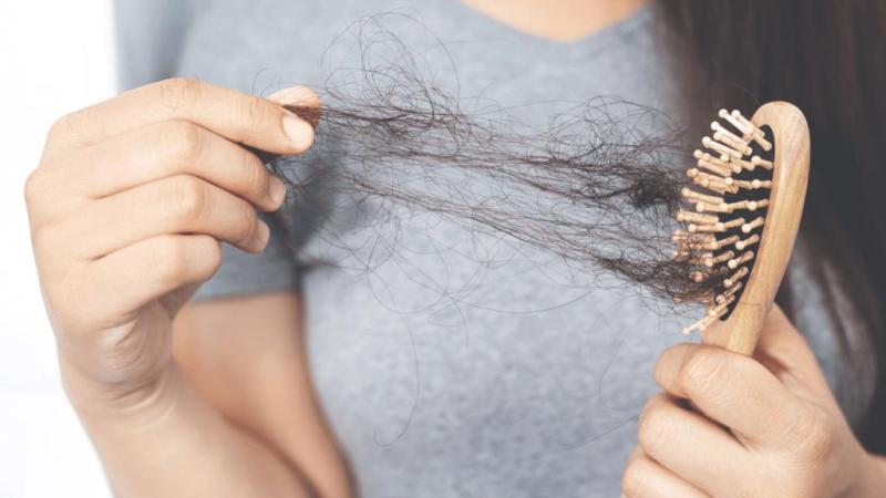 每次洗头，头发大把的掉是怎么回事？天天洗会脱发吗？