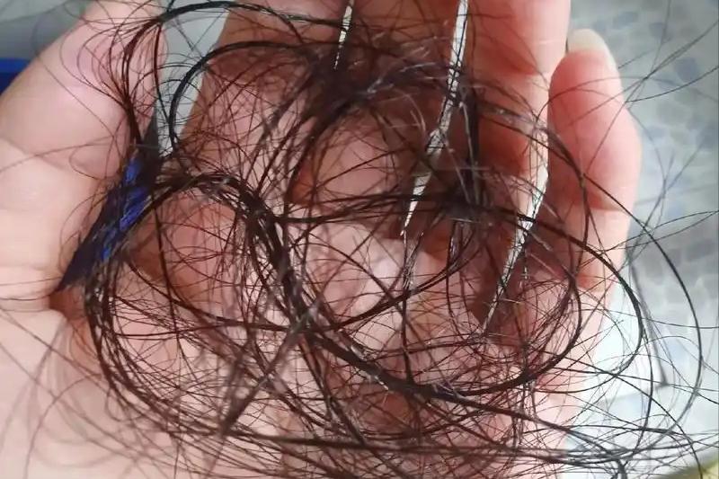 身体缺什么会大把掉头发？原因告诉您秀发自己长出来