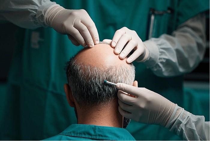 毛发医疗的标准时刻到了,雍禾医疗如何助力行业标准化